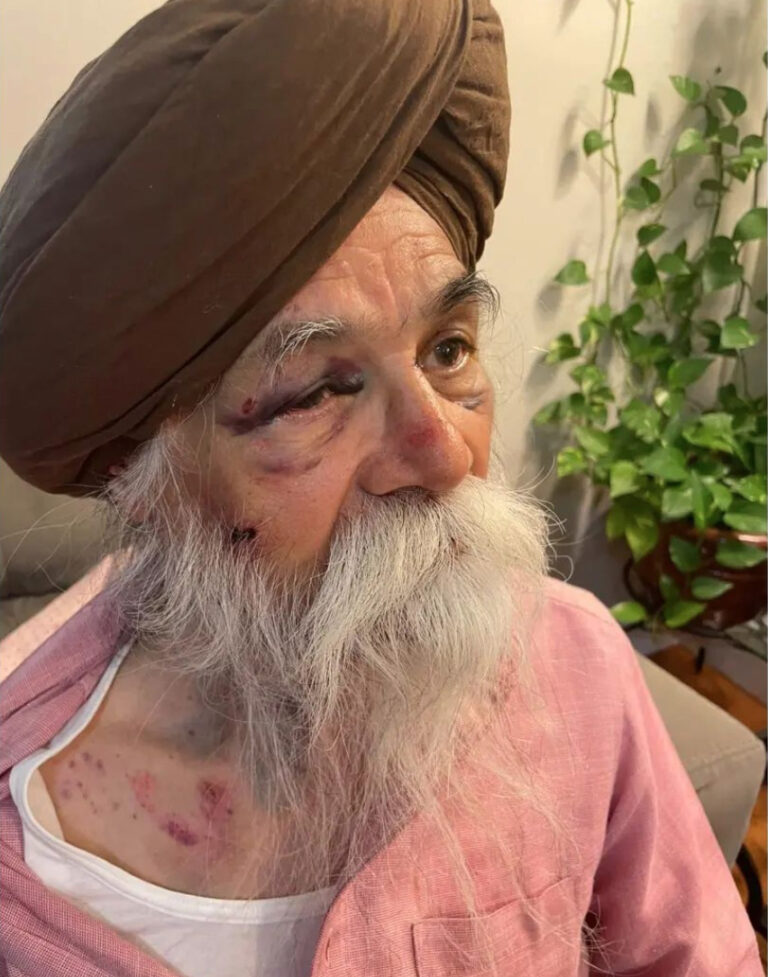 82 ਸਾਲਾ ਸਿੱਖ ਸਾਹਿਤਕਾਰ ਉਂਕਾਰ ਸਿੰਘ ‘ਤੇ ਰਿਚਮੰਡ ਹਿੱਲ ‘ਚ ਲੁਟੇਰਿਆਂ ਵੱਲੋਂ ਹਮਲਾ